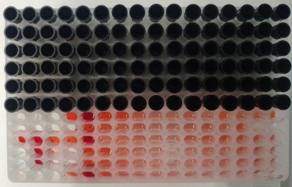 采血試管視覺顏色識別